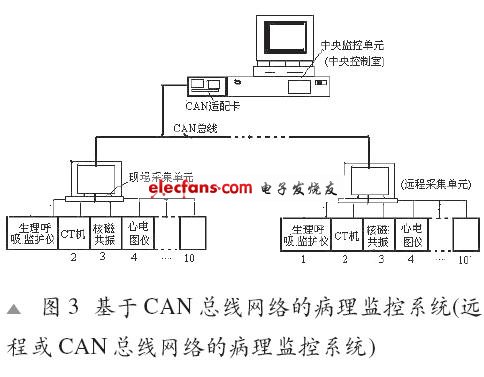 CAN总线