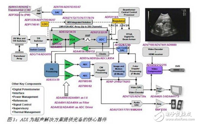 ADI为超声解决方案提供完备的核心器件