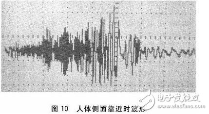 智能马桶盖