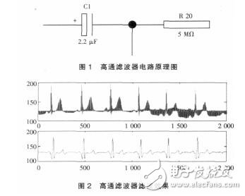 心电信号滤波器的设计