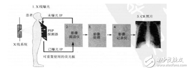 CR成像系统的构造与成像原理分析