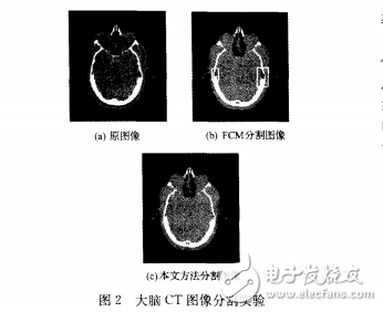 基于FCM聚类算法的新型图像分割算法分析