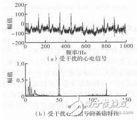 心电信号检测中滤除肌电干扰的方法解析