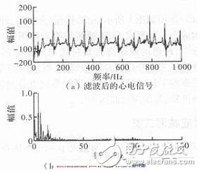 心电信号检测中滤除肌电干扰的方法解析