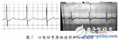 BIH心电数据D／A回放设计