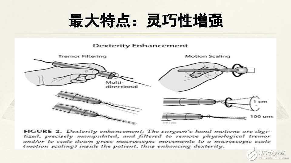 一文看懂手术机器人的现状和未来前景