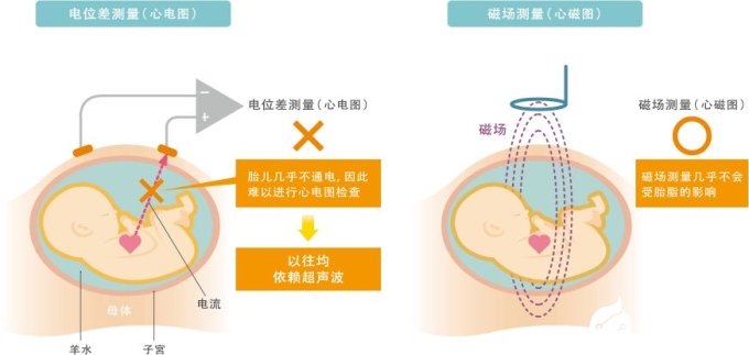 MR生物磁性传感器的特点以及各种应用解析